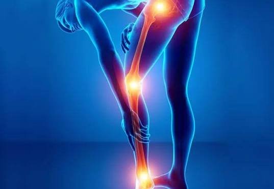 Sciatica